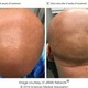 Imagen para el artículo titulado Un efecto secundario en un nuevo fármaco contra la dermatitis devuelve el pelo a una paciente con alopecia